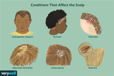 Recognizing the Signs of an Itchy Scalp