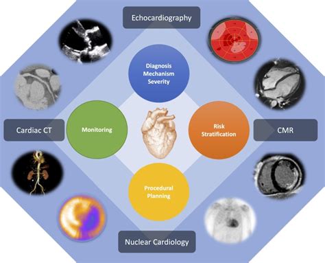 Revolutionary Imaging Techniques in Modern Cardiac Surgeries