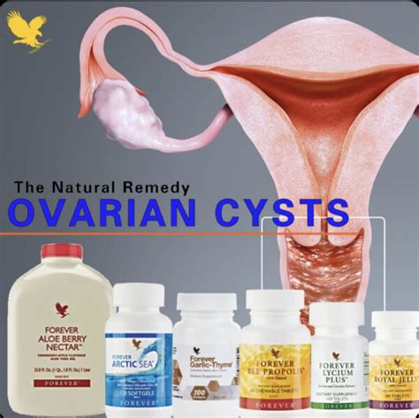 Supporting Your Overall Well-Being While Living with Ovarian Cysts