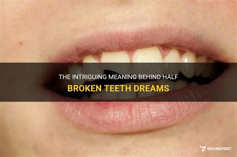 Symbolic Meaning of a Cracked Tooth in Dreams