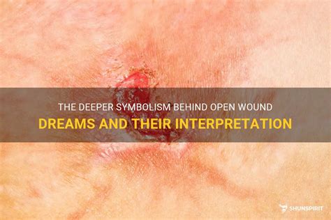 Symbolism of self-inflicted wounds in dreams