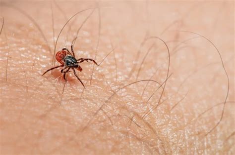 Tackling Tick Infestations: Effective Methods for Eliminating Tick Populations