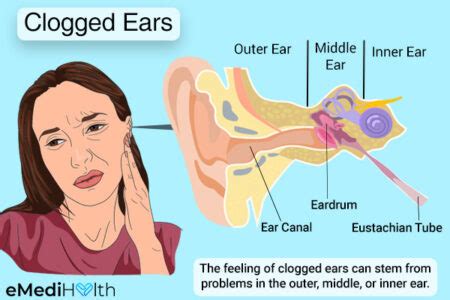 The Common Causes of a Blocked Ear