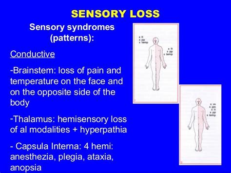 The Enigmatic Phenomenon of Facial Sensation Loss