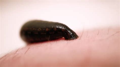 The Enigmatic and Symbolic Significance of Dreams with Leeches on Feet