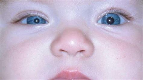 The Fascination of Oversized Infant Pupils: A Scientific Exploration