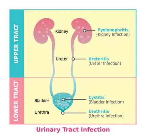 The Hazards and Perils of Ingesting Urine