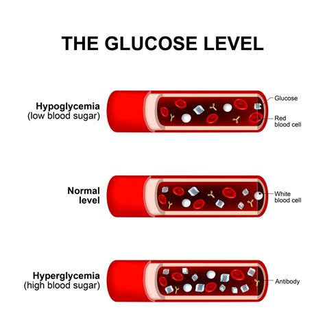 The Hazards of Elevated Glucose Levels