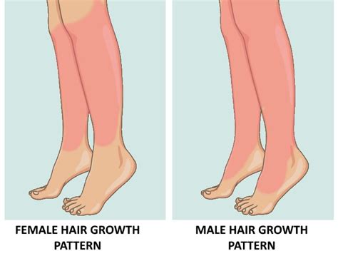 The Influence of Hormones on Leg Hair Growth and Strategies for Hormonal Balance