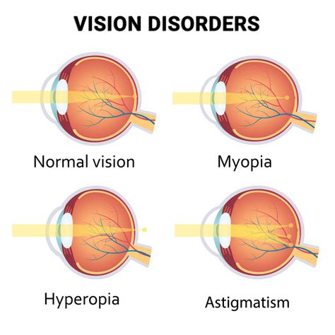 The Link between Vision Disorders and Self-Reflection