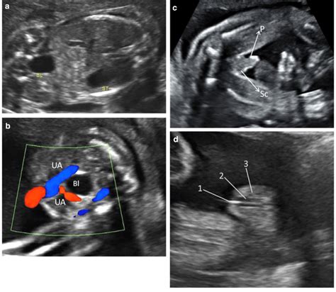 The Miracle of Life: Unraveling the Significance Hidden within a Fetal Sonogram