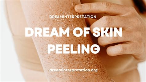 The Psychological Significance of Dreams Depicting Legs with Peeling Skin