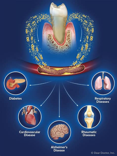 The Relationship Between Gum Disease and Overall Health