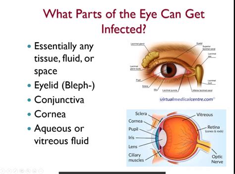 The Relationship Between Ocular Infections and the World of Dreams