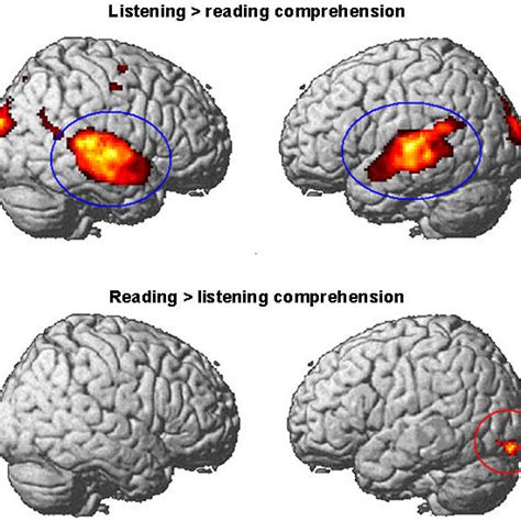 The Science Behind Mute Terror: Exploring the Brain's Activity