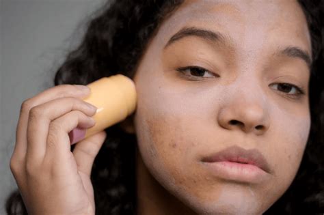 The Science behind Pimple Popping Dreams: Causes and Triggers