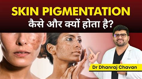 The Science behind Skin Pigmentation