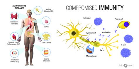 The Significance of Sustaining an Optimal Immune System