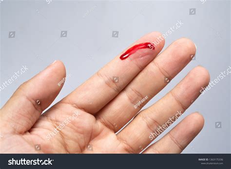 The Symbolic Meaning of the Bleeding Finger