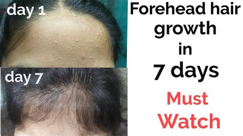 The Symbolic Significance of Hair Growing on the Forehead