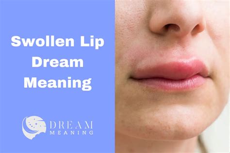 The Symbolism of Dreaming about a Swollen Lip