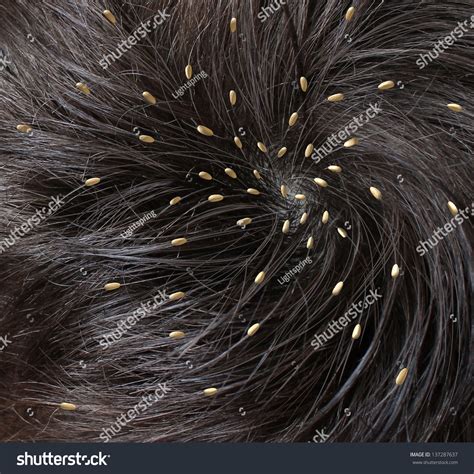 The Symbolism of Lice Infestation on the Scalp