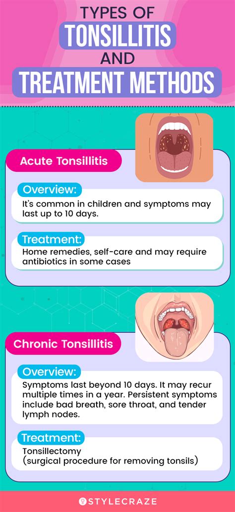 Treatment Options for Tonsillitis