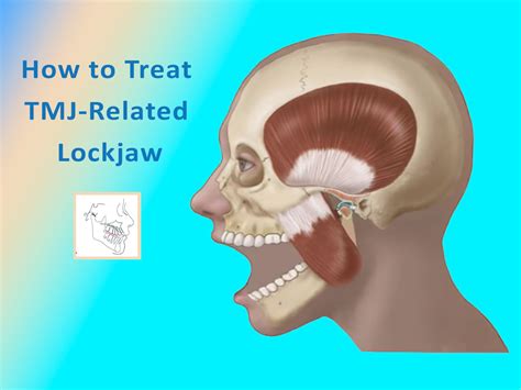 Treatment options for a locked jaw: From conservative measures to surgical interventions