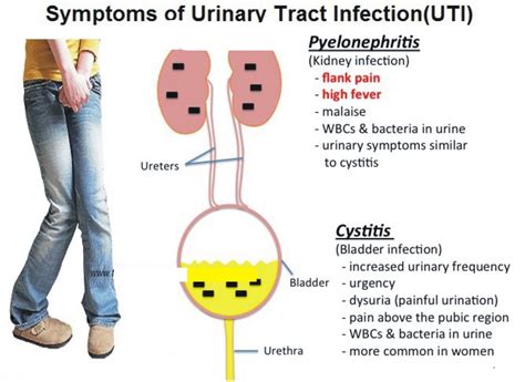 Troubleshooting Common Issues: Dealing with Infections, Irritations, and Migration