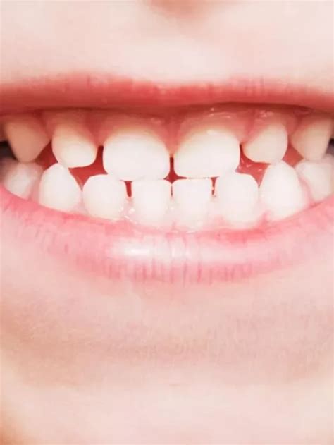 Understanding Tooth Growth: The Basics