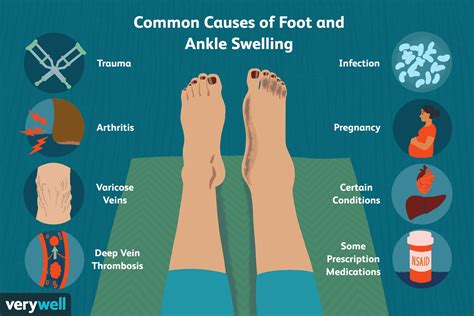 Understanding the Factors that Trigger Swelling in Feet and Ankles