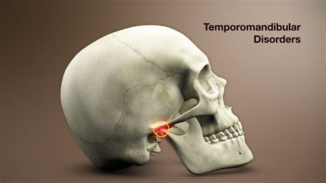 Understanding the Root Cause: The Mechanics Behind Temporomandibular Joint Disorder