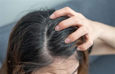 Understanding the Sensation of an Itchy Scalp