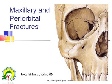 Unlocking the Meaning: Cultural Perspectives on Dreaming of Facial Fractures