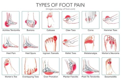 Unraveling the Meaning: Different Types of Toe Injuries