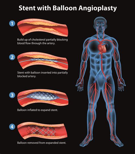 Unraveling the Symbolic Significance of Cardiac Interventions