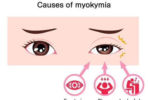 Unraveling the Symbolism of Eyelids in Dream Interpretation