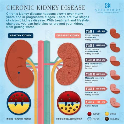 Unveiling the Hidden Significance of Representations Associated with Cancer in the Kidneys