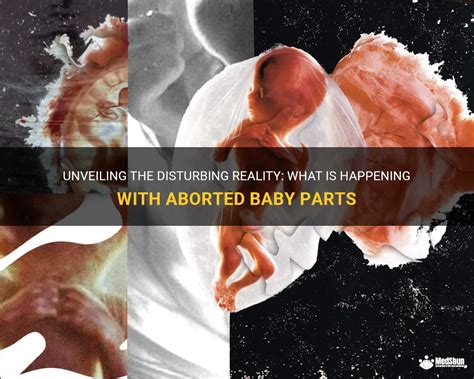 Unveiling the Subconscious Longings of an Aborted Offspring