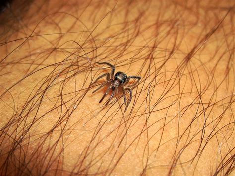 What Do Experts Say? Understanding the Interpretation of Spider Bites in Dreams