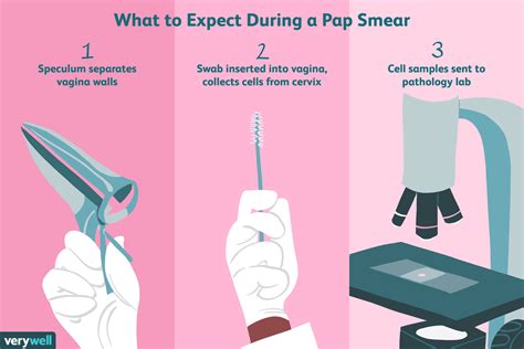 What to Anticipate During a Pap Test Appointment