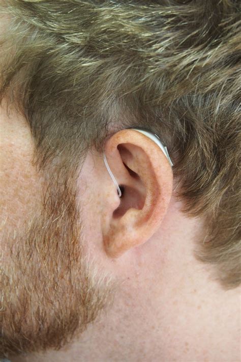 When to Seek Professional Assistance for Ear Cleaning